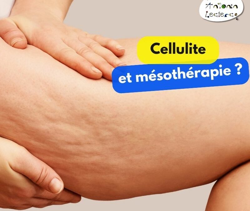 Cellulite et mésothérapie