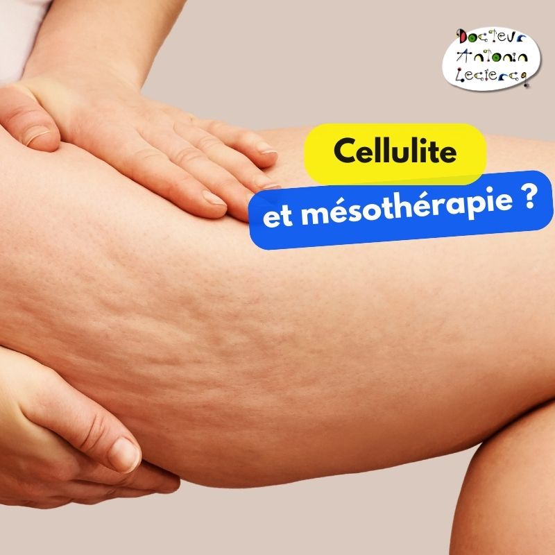 cellulite et mesotherapie