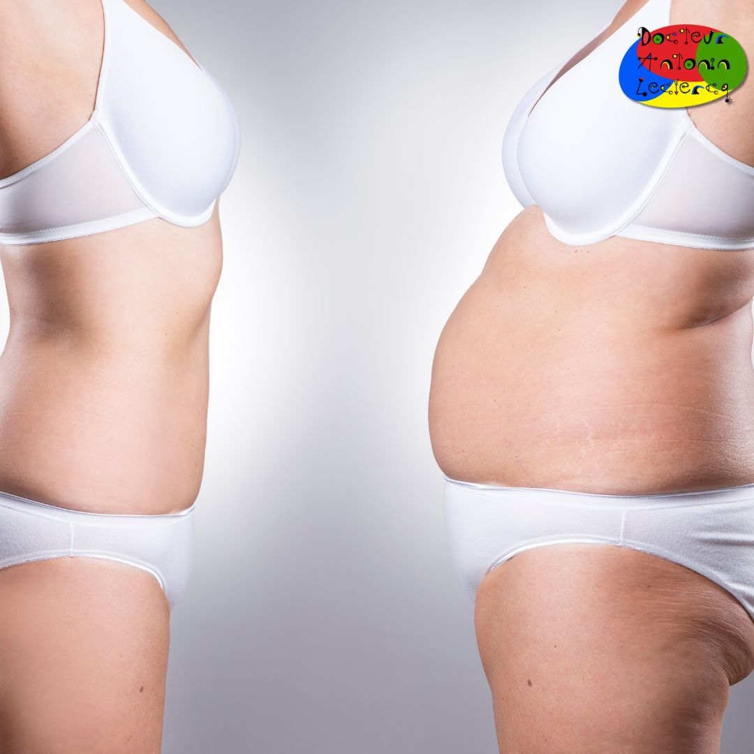 resultat Mounjaro nutrition